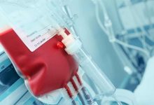 از دست دادن چند لیتر از خون باعث مرگ میشود؟