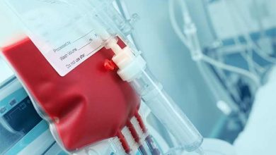 از دست دادن چند لیتر از خون باعث مرگ میشود؟