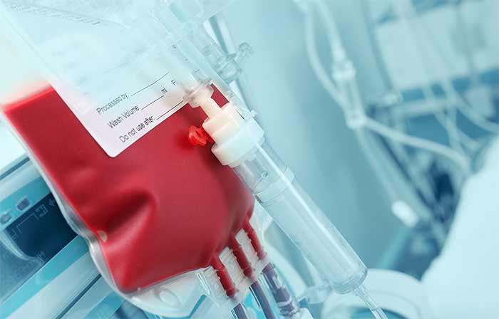 از دست دادن خون از دست دادن چند لیتر از خون باعث مرگ میشود؟