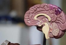 ساختار مغز و ذهن+ فرق ذهن و هوش